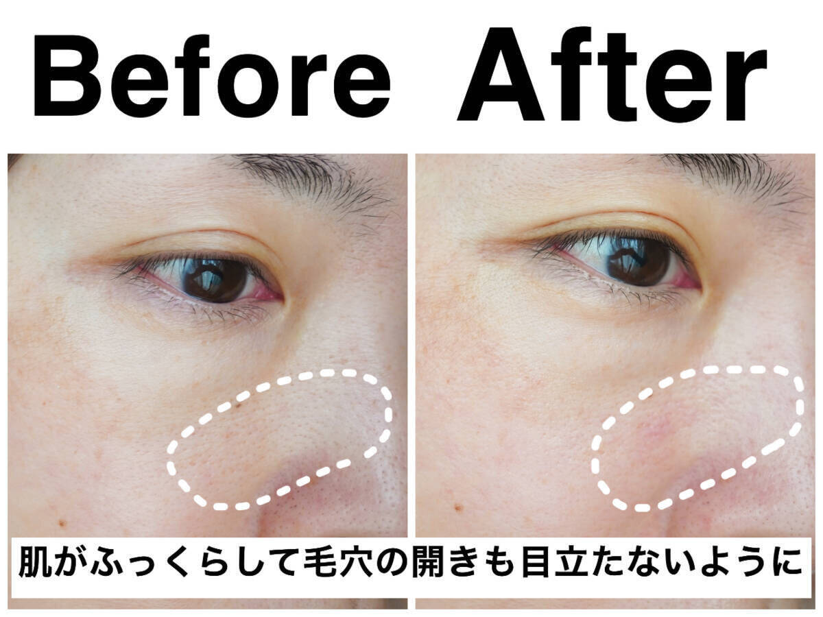 ハリと毛穴が気になる美容ライターが10日間実際に使ってみた！人気美容液の正直レビュー