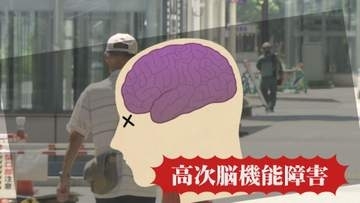 「大脳は43度で溶け始める」熱中症が引き起こす後遺症　簡単にできる“脱水”のセルフチェックで早期の対応を