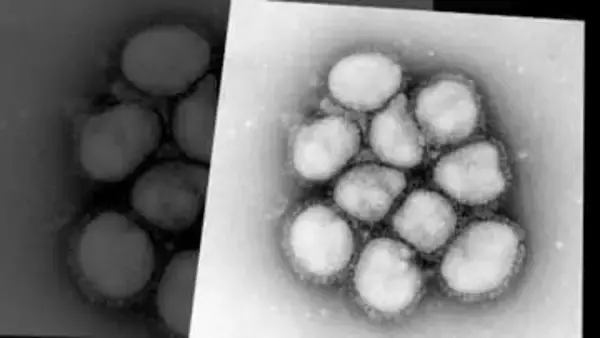 【インフルエンザ再流行】今度は“B型”が急増 札幌市では注意報レベルに―例年とは異なる“高熱”に注意 医師は「全然イメージが違う」―流行のワケは“最強寒波”で暖房強め室内乾燥か まだ間に合うワクチン