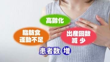 早期発見、転移なしなら5年生存率99％　女性の8人に1人がかかる乳がん　「自分の乳腺を知る」ことで変化に気付きを