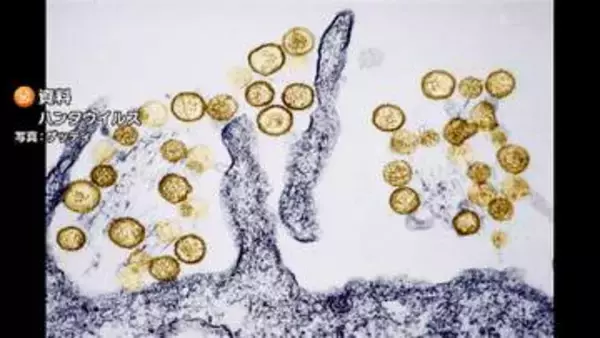ヒトからヒトへの感染の可能性　クルーズ船でハンタウイルス