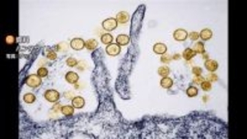 ヒトからヒトへの感染の可能性　クルーズ船でハンタウイルス