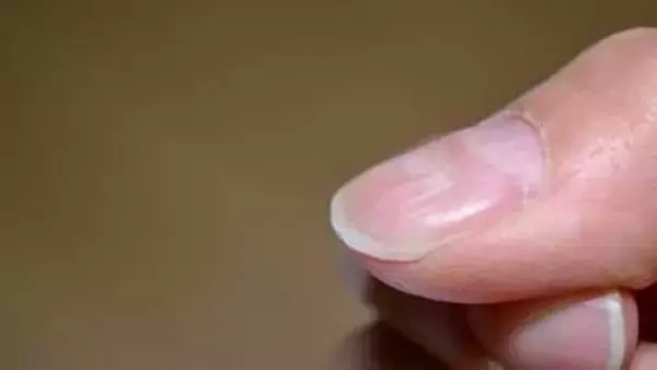 爪の縦線やでこぼこは年齢のせいじゃない？「乾燥」対策を3カ月徹底すれば“美爪”を生む土台は整えられる