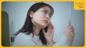 “ニキビ”の低年齢化…原因は生活習慣の変化に？早期治療の重要性・正しい洗顔方法を医師に聞く