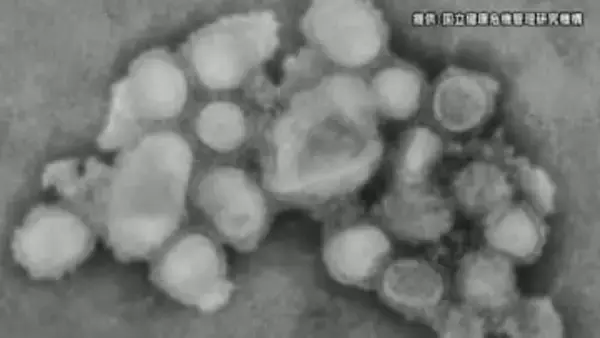 【速報】インフルエンザ患者数1.4倍に…増加は5週連続で前週に続き「警報レベル」　1医療機関あたり43.34人