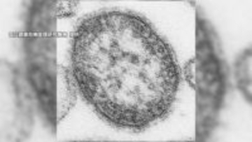 「はしか」感染者数は197人と去年同時期の3倍　直近10年で最多の2019年に次ぐ水準　海外渡航歴ない感染者も増加