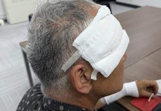 「クマだと思った次の瞬間、倒されていた」仙台市で今年初のクマ被害　襲われた60代男性が語る衝撃の一瞬