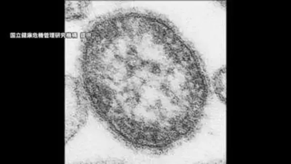 はしか感染者197人…2025年の3倍超、2019年に次ぐ高水準　海外からウイルス…渡航歴ない人にも拡大