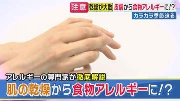 「乾燥肌が“食物アレルギー”の入り口に」？　秋の乾燥シーズンに見落とされる“危険な落とし穴”　突然“魚アレルギー”で突然アナフィラキシーショックの事例も　保湿対策の重傷性などを専門家が解説