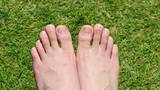 「足のすっぴん爪を見せるのが恥ずかしい…なら今すぐ靴を見直して！「つま先から1cmのゆとり」と「正しい爪切り」が美爪再生の近道」の画像1