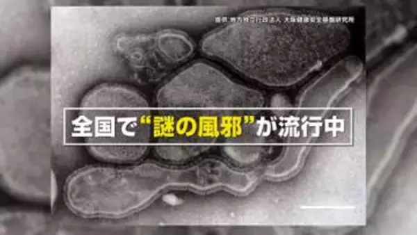 【専門家解説】「せきが止まらない、長引く」“謎の風邪”の正体！？ヒトメタニューモウイルスとは？