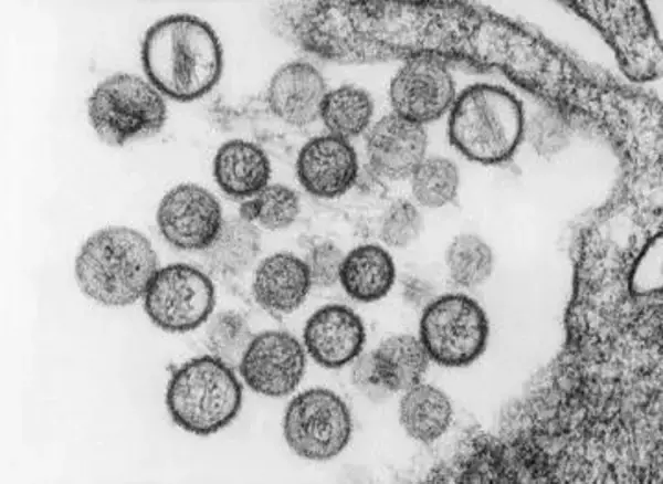ハンタウイルス感染者は計6人に　いずれも「アンデス株」　新たにクルーズ船から降りた男性1人が感染疑い　WHO発表