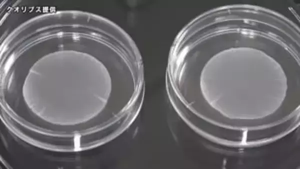 世界初iPS細胞製品 3月上旬にも承認へ　上野厚労相「患者さんの手元に早く届くことを期待」