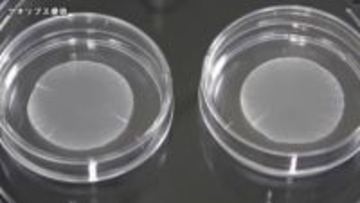 世界初iPS細胞製品 3月上旬にも承認へ　上野厚労相「患者さんの手元に早く届くことを期待」