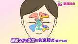 「「痰が絡む人の半数は副鼻腔炎」実は虫歯が引き金になることも…放置すると髄膜炎のリスク　異変を感じたら鼻うがい、早期受診を」の画像1