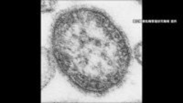 「はしか」の感染者数増　上野厚労大臣「ワクチン接種検討を」