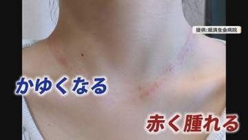 「安物ほど危険」医師が警鐘　汗ばむ季節はリスク高い金属アレルギー…夏場にピアス穴を開けるのもNG行動