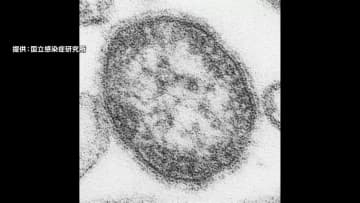 0歳の男の子がはしか感染　ワクチン接種受けず海外から1日に入国　区役所で接触した職員150人に健康観察　東京・台東区