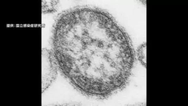 0歳の男の子がはしか感染　ワクチン接種受けず海外から1日に入国　区役所で接触した職員150人に健康観察　東京・台東区