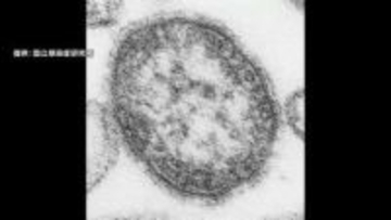 0歳の男の子がはしか感染　ワクチン接種受けず海外から1日に入国　区役所で接触した職員150人に健康観察　東京・台東区