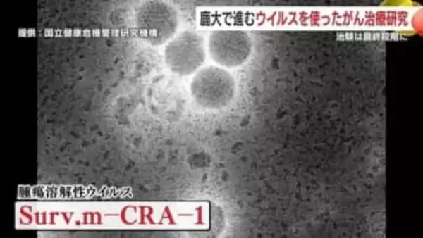 「風邪ウイルスを“がんキラー”に」鹿児島大発ベンチャーの治療薬、2025年11月から最終治験へ
