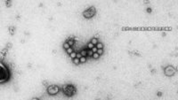 「吐く量が多かった」給食パンで集団食中毒　ノロ陽性は直接パンに触れない配送担当だけ…それでもなぜ感染？