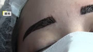 【独自】無資格「アートメイク」警察に相談を！厚労省が自治体に通知　美容後遺症外来の医師「医療の枠の中でやること大事」