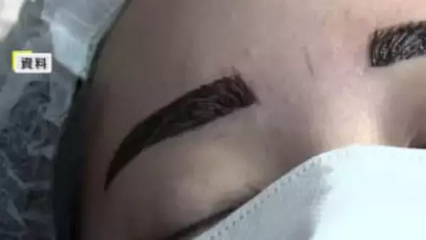 【独自】無資格「アートメイク」警察に相談を！厚労省が自治体に通知　美容後遺症外来の医師「医療の枠の中でやること大事」