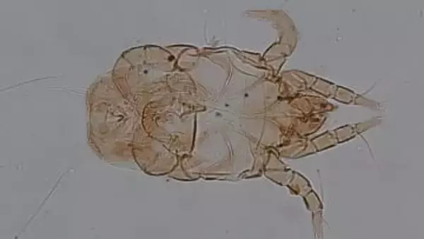 目に見えない「チリダニ」こそダニ問題の黒幕!?生体、死骸、ふんの全てがアレルゲンになる恐ろしい生態と効果的な駆除法