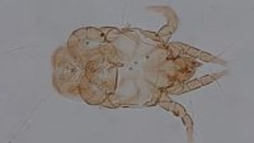 目に見えない「チリダニ」こそダニ問題の黒幕!?生体、死骸、ふんの全てがアレルゲンになる恐ろしい生態と効果的な駆除法