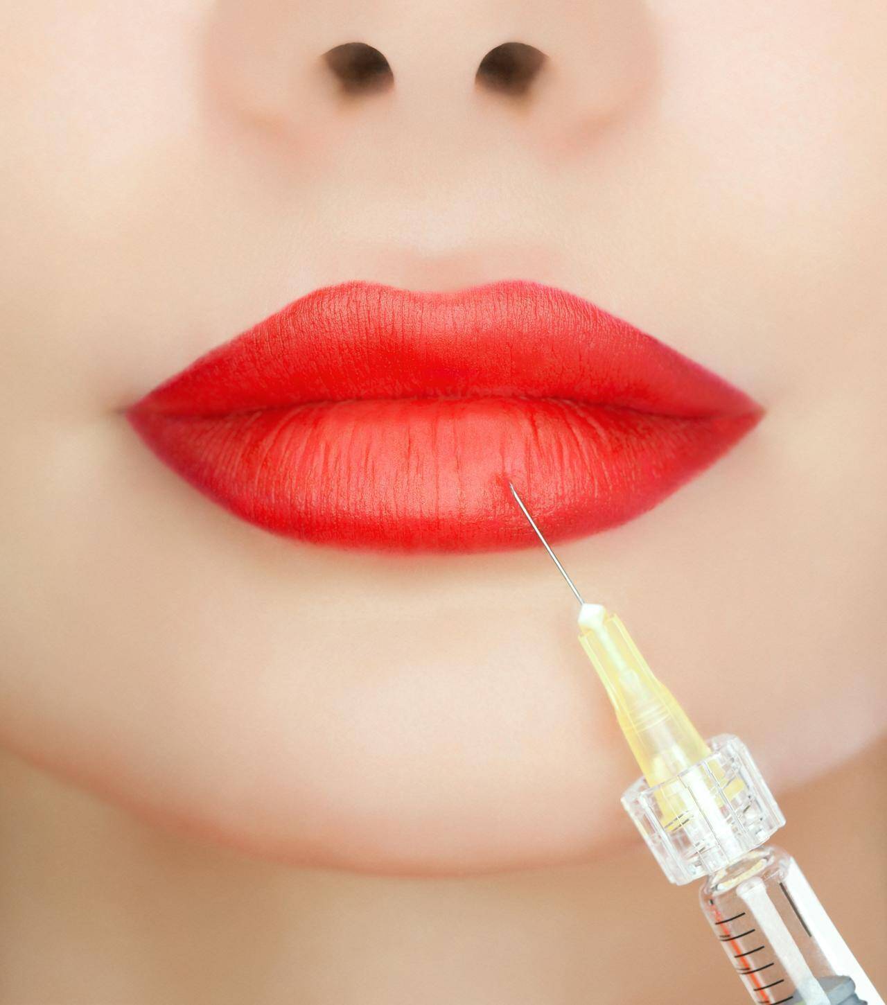 女性の アソコ に あるもの を注入する美容整形に黄色信号 19年6月15日 エキサイトニュース