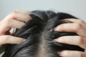 男性の育毛剤、満足度やコスパ1位の商品は…利用経験者に聞いた結果　民間企業が主要ブランド調査