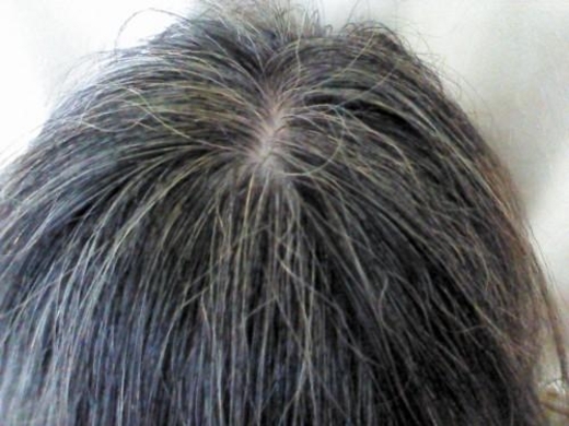 ボクの彼女に白髪があった 白髪で母親を思い出しゲンナリ 10年2月9日 エキサイトニュース