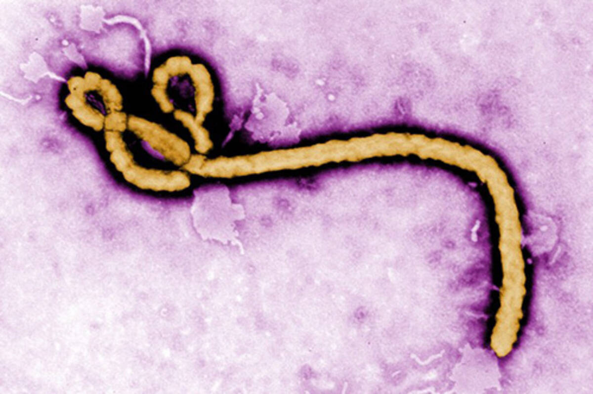 エボラウイルスが恐ろしい理由 西アフリカでのエボラ出血熱流行を受けて 西川伸一 The Club Medエッジ 14年9月18日 エキサイトニュース