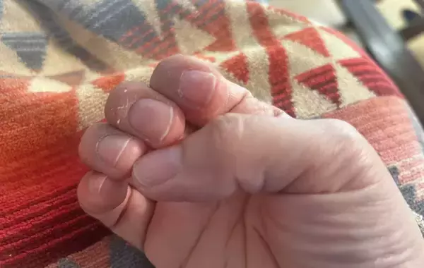 「母の手荒れを見た3歳児　ひと言に「笑ってしまった」「カサカサも悪くない」」の画像