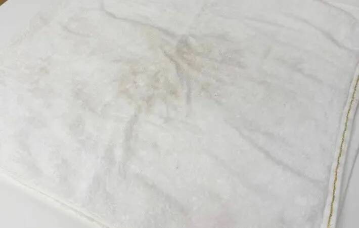 梅雨時のタオル、毎日洗ってるのになぜ臭う？　洗濯のプロが教える「落とし穴」とは…