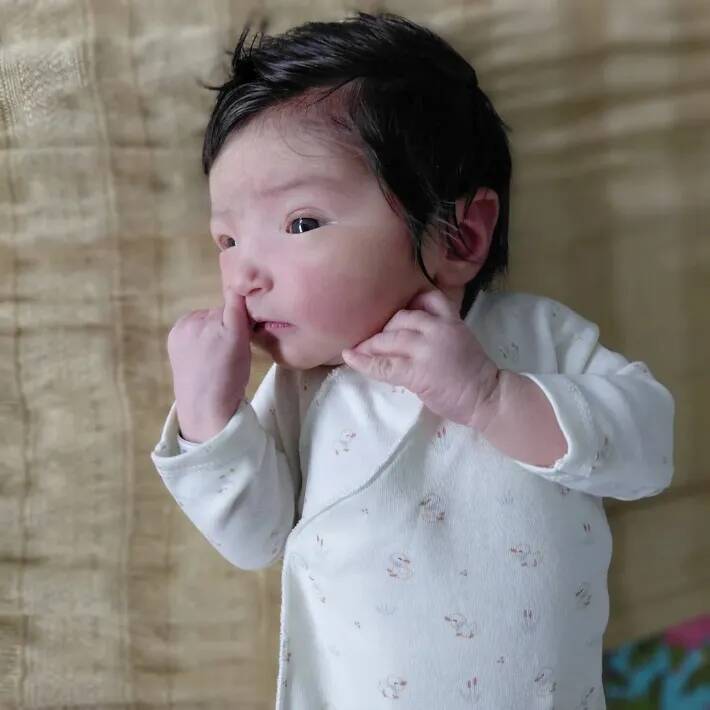 「こんな子、見たことない！」　生まれた瞬間、誰もが驚いた赤ちゃんの『姿』とは？