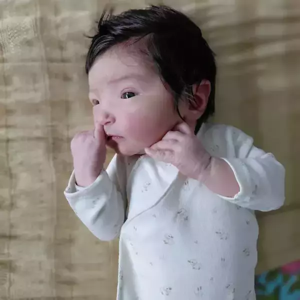 「「こんな子、見たことない！」　生まれた瞬間、誰もが驚いた赤ちゃんの『姿』とは？」の画像