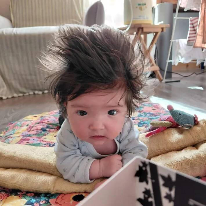 「こんな子、見たことない！」　生まれた瞬間、誰もが驚いた赤ちゃんの『姿』とは？