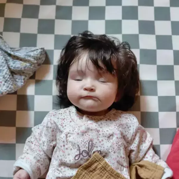 「「こんな子、見たことない！」　生まれた瞬間、誰もが驚いた赤ちゃんの『姿』とは？」の画像