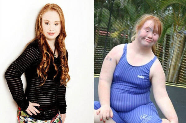 ダウン症の方へ勇気を スーパーモデルにまで上りつめた18歳の少女の努力と成功体験に感動 16年8月27日 エキサイトニュース