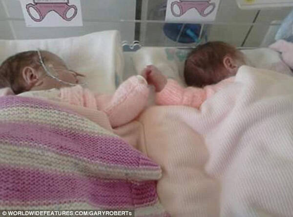 未熟児で生まれ 生後7週まで離れ離れだった双子 ようやく同じベッドに寝る事ができた瞬間 16年11月日 エキサイトニュース