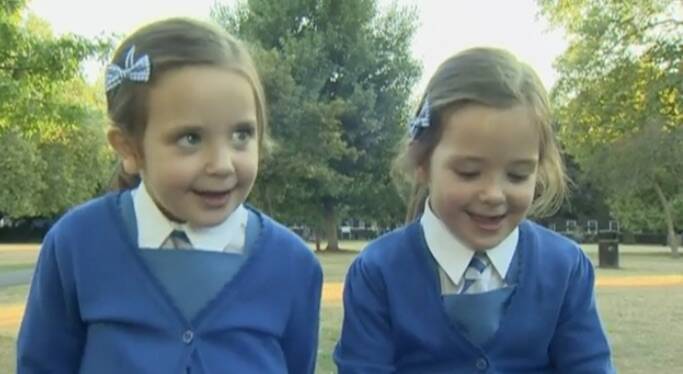 頭は2つで腹部が繋がった状態で生まれた双子 母に求められた決断 手術か それとも 16年10月8日 エキサイトニュース 2 2