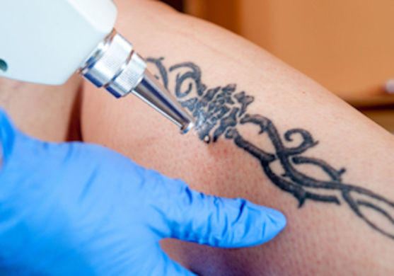 タトゥーを入れて 後悔 が9割 男性の半数は タトゥーを入れた人は絶対に恋愛対象外 と回答 17年9月26日 エキサイトニュース