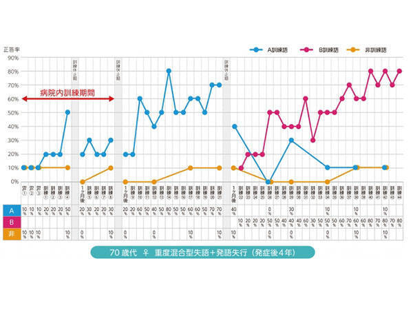Pepper君が失語症者のリハビリに活躍！今後の実用化に期待