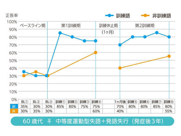 Pepper君が失語症者のリハビリに活躍！今後の実用化に期待