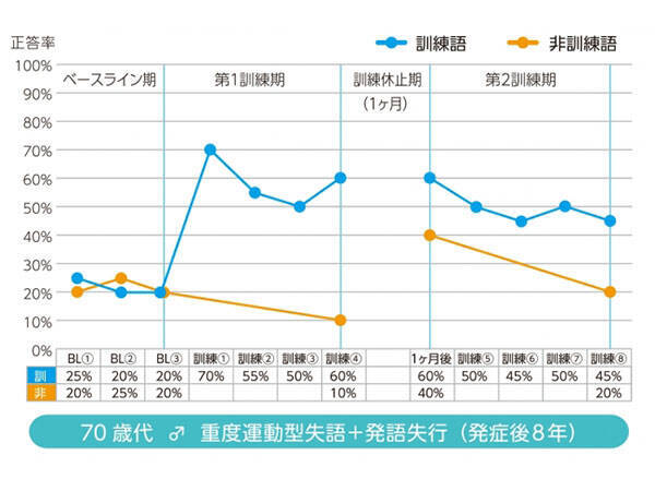 Pepper君が失語症者のリハビリに活躍！今後の実用化に期待