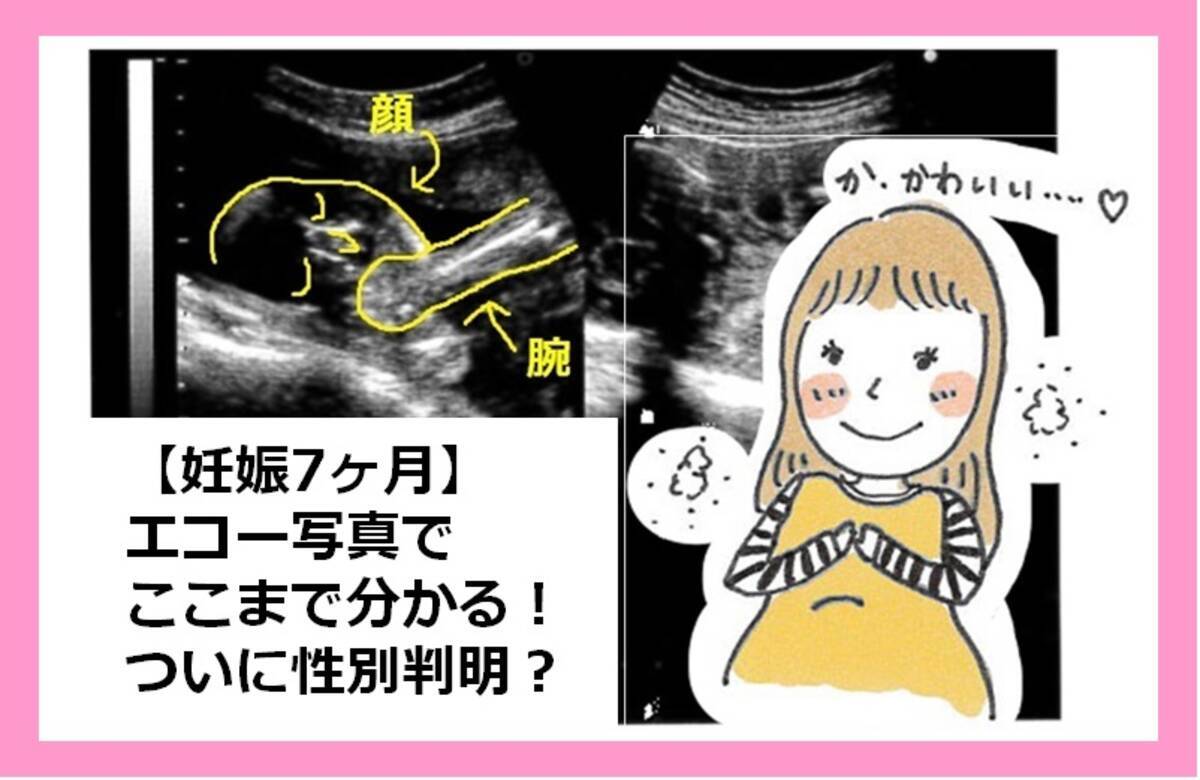 妊娠7ヶ月 エコー写真でここまで分かる ついに性別判明 25歳はじめての妊娠 8 18年3月21日 エキサイトニュース