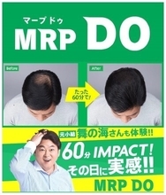 太めの髪でボリュームアップ　アートネイチャーの新増毛「MRP DO（マープドゥ）」