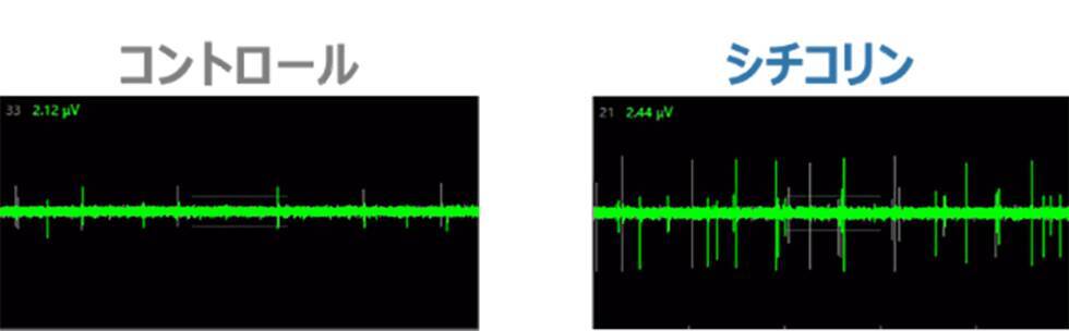 キリンと富士通、創薬DX技術を活用し、AIと実試験でシチコリンの腸脳作用メカニズムを解明